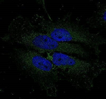 Aquaporin 2 Antibody in Immunocytochemistry (ICC/IF)