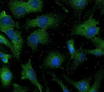 Aquaporin 2 Antibody in Immunocytochemistry (ICC/IF)