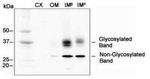 Aquaporin 2 Antibody in Western Blot (WB)