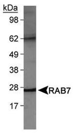 RAB7 Antibody in Western Blot (WB)