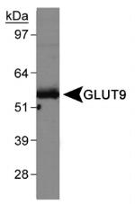 GLUT9 Antibody in Western Blot (WB)
