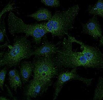 LDLR Antibody in Immunocytochemistry (ICC/IF)