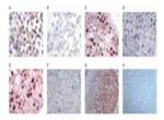 FANCD2 Antibody in Immunohistochemistry (IHC)