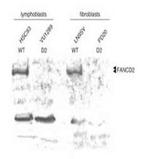 FANCD2 Antibody in Western Blot (WB)