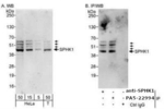SPHK1 Antibody in Western Blot (WB)