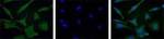 TYRO3 Polyclonal Antibody