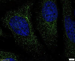 TMEM97 Polyclonal Antibody