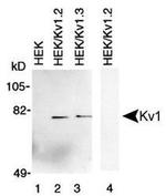 KV1.2 (KCNA2) Antibody in Western Blot (WB)