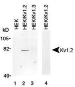 KV1.2 (KCNA2) Antibody in Western Blot (WB)