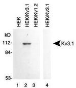 KV3.1 (KCNC1) Antibody in Western Blot (WB)