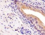 PICK1 Antibody in Immunohistochemistry (IHC)