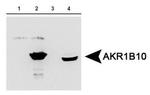 AKR1B10 Antibody in Western Blot (WB)