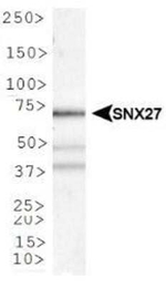 SNX27 Antibody in Western Blot (WB)