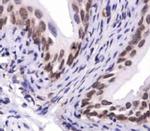 SNX27 Antibody in Immunohistochemistry (Paraffin) (IHC (P))