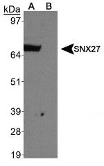 SNX27 Antibody in Western Blot (WB)
