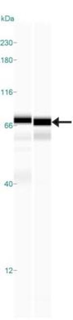SNX27 Antibody in Western Blot (WB)