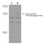 Phospho-Blooms Syndrome (Thr99) Antibody in Western Blot (WB)