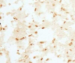 RCAN1 Polyclonal Antibody