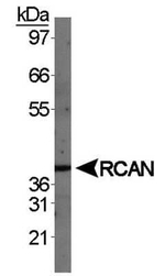 RCAN1 Antibody in Western Blot (WB)