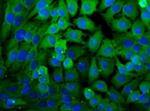 LDHA Polyclonal Antibody