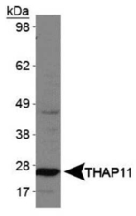 THAP11 Antibody in Western Blot (WB)