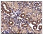 GLUT4 Antibody in Immunohistochemistry (IHC)