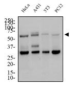 GLUT4 Antibody in Western Blot (WB)