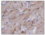 TIGAR Polyclonal Antibody