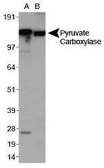 Pyruvate Carboxylase Antibody in Western Blot (WB)