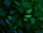 CX3CL1 Antibody in Immunocytochemistry (ICC/IF)