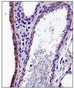 CX3CL1 Antibody in Immunohistochemistry (Paraffin) (IHC (P))