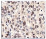 SIRT1 Polyclonal Antibody