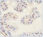 SLITRK1 Antibody in Immunohistochemistry (IHC)