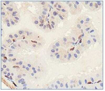 SLITRK1 Polyclonal Antibody