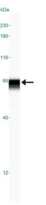 USP22 Polyclonal Antibody