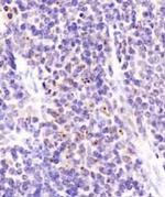 DEPDC6 Antibody in Immunohistochemistry (IHC)
