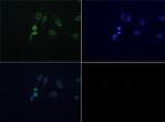 FUS Antibody in Immunocytochemistry (ICC/IF)