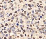 FUS Antibody in Immunohistochemistry (IHC)