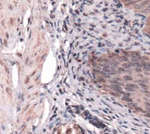 SDHB Antibody in Immunohistochemistry (Paraffin) (IHC (P))