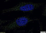 LIPA Polyclonal Antibody