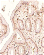 LIPA Antibody in Immunohistochemistry (Paraffin) (IHC (P))