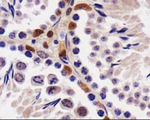 STK33 Antibody in Immunohistochemistry (Paraffin) (IHC (P))