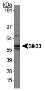 STK33 Antibody in Western Blot (WB)