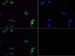 SDHA Antibody in Immunocytochemistry (ICC/IF)