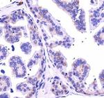 Dicer Antibody in Immunohistochemistry (Paraffin) (IHC (P))