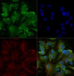 TRAIL-R2 (DR5) Polyclonal Antibody
