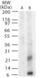 West Nile Virus Glycoprotein M Polyclonal Antibody