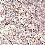 CXCR3 Antibody in Immunohistochemistry (Paraffin) (IHC (P))