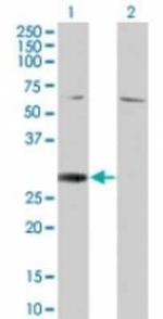 RGS18 Antibody in Western Blot (WB)