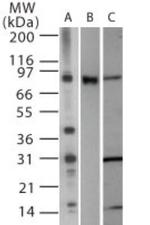 TLR2 Polyclonal Antibody